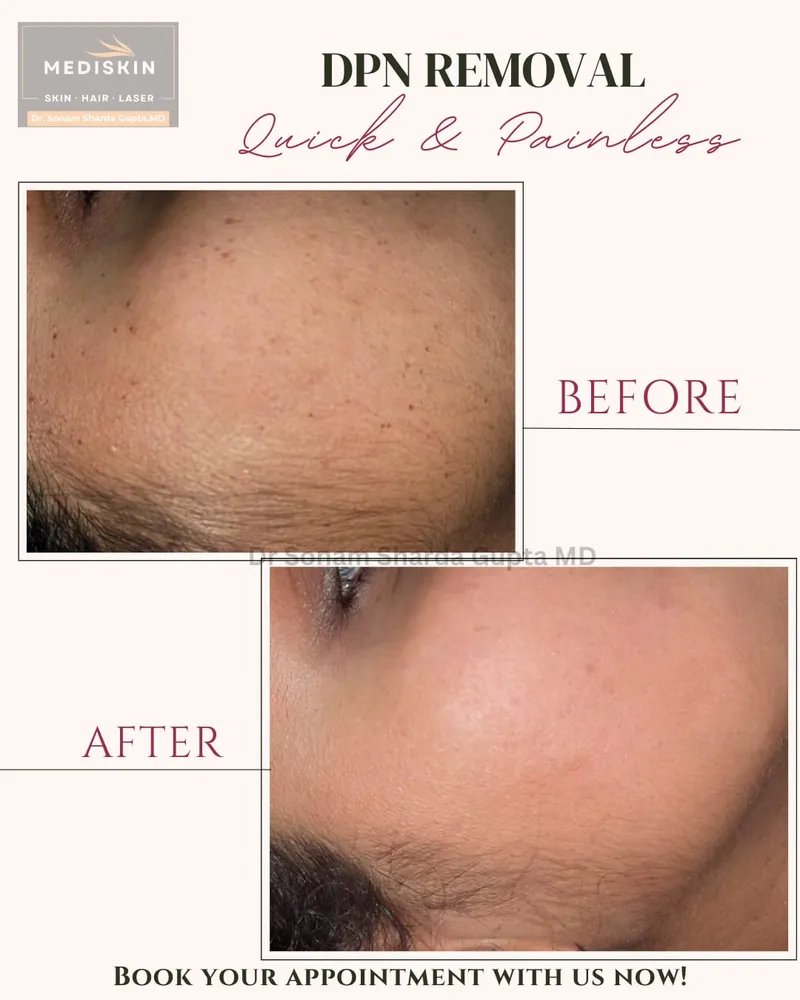 Dermatologist near Dhantoli