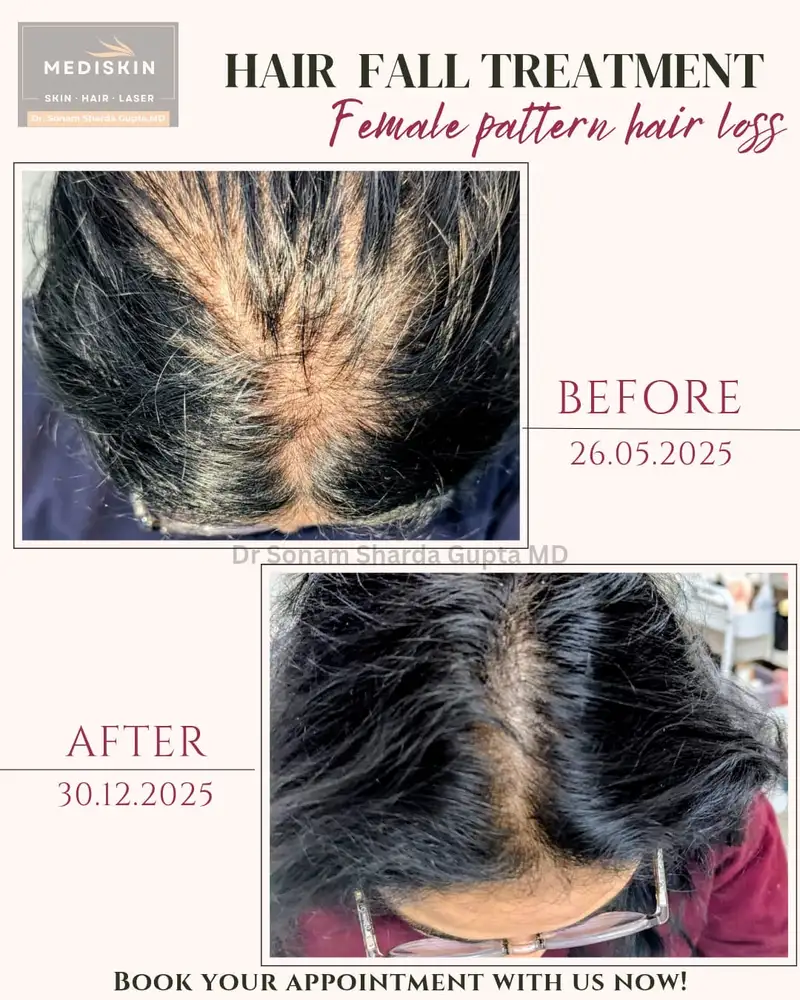 Dermatologist near Dhantoli