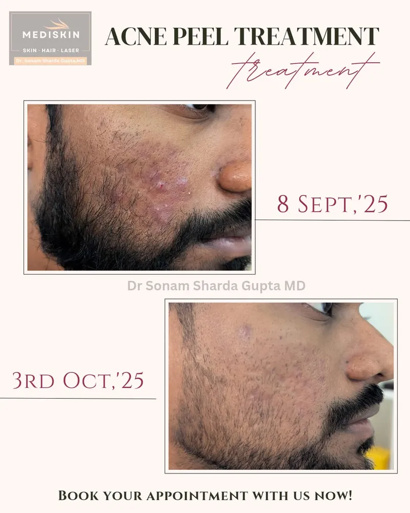 Dermatologist near Dhantoli