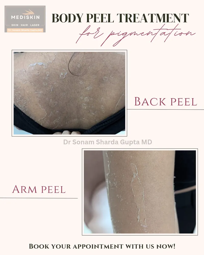 Dermatologist near Dhantoli