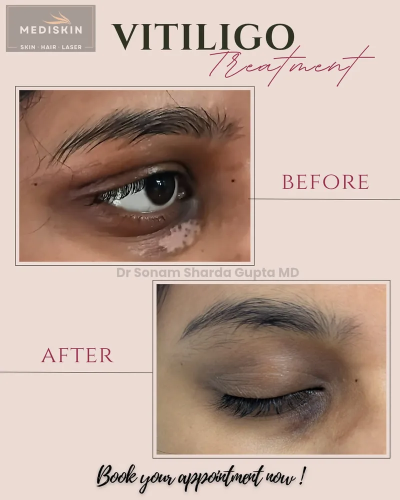 Dermatologist near Dhantoli