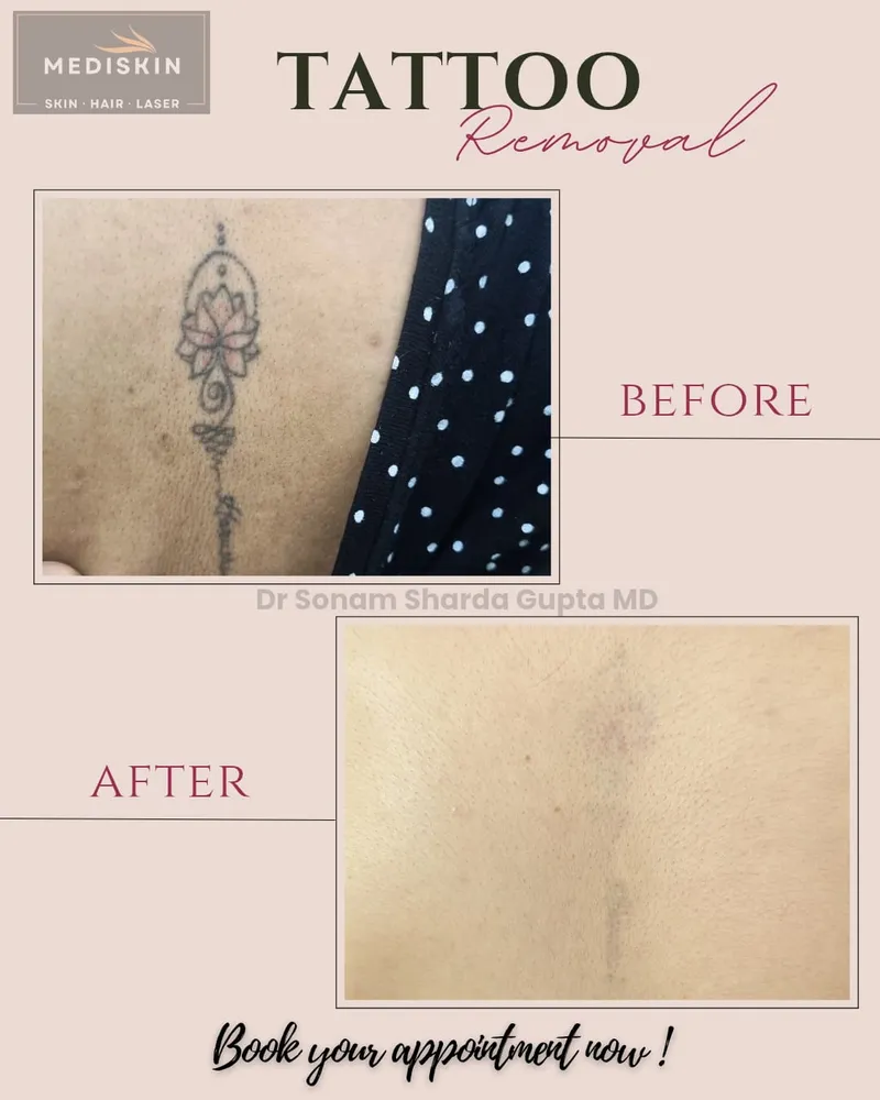 Dermatologist near Dhantoli