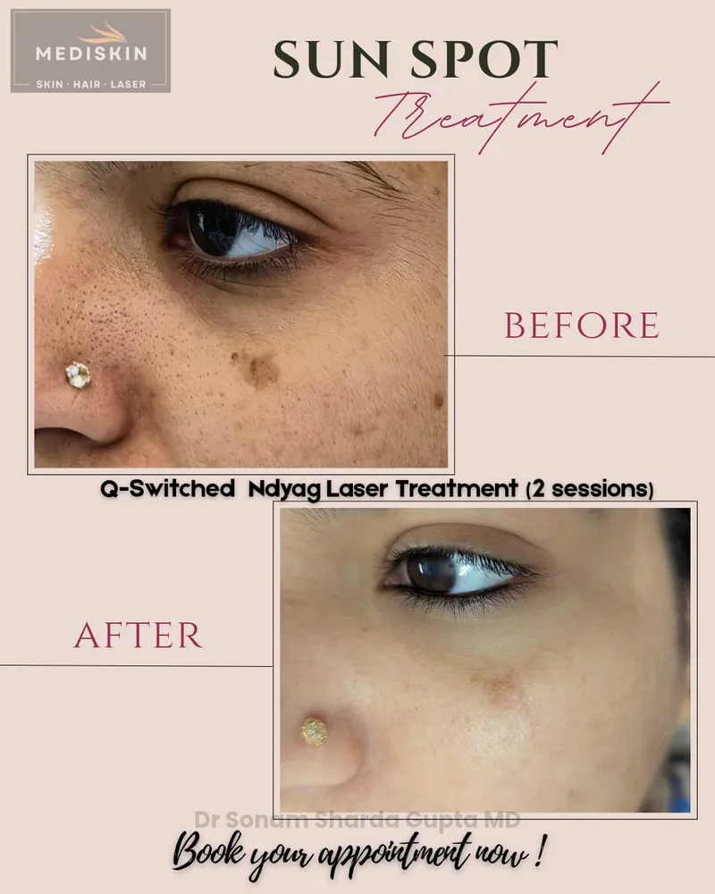 Dermatologist near Dhantoli
