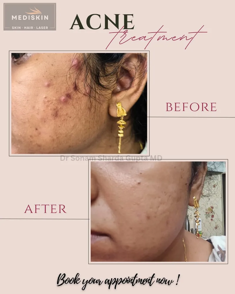 Dermatologist near Dhantoli
