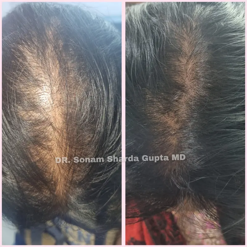 Dermatologist near Dhantoli