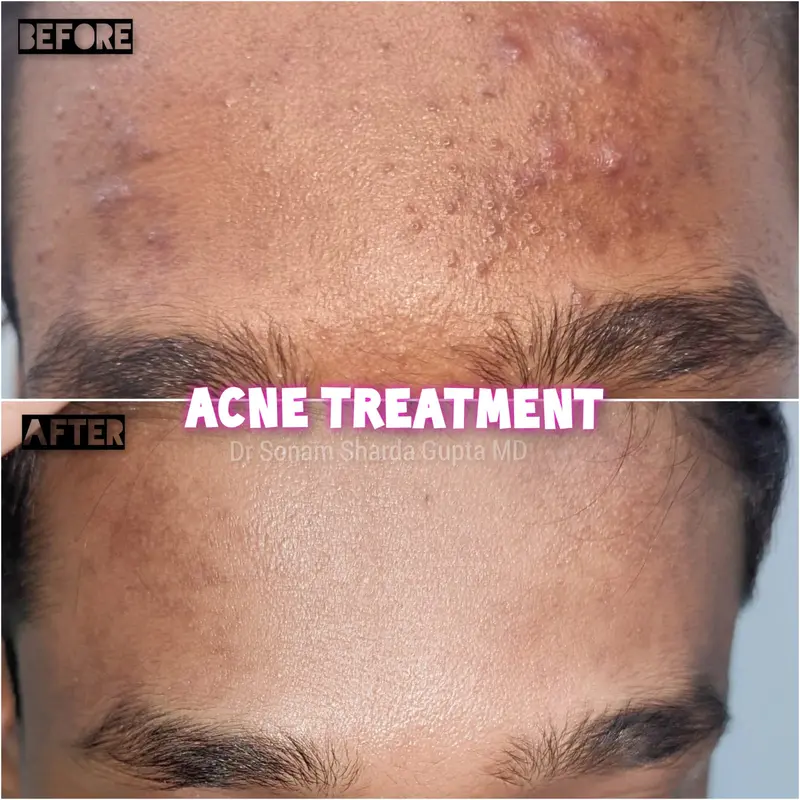 Dermatologist near Dhantoli
