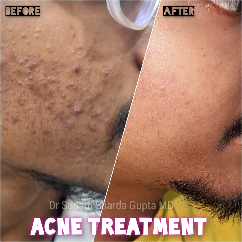 Dermatologist near Dhantoli