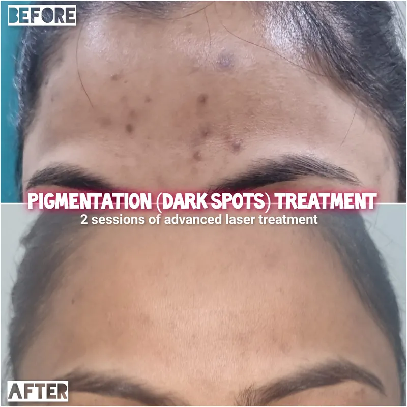 Dermatologist near Dhantoli