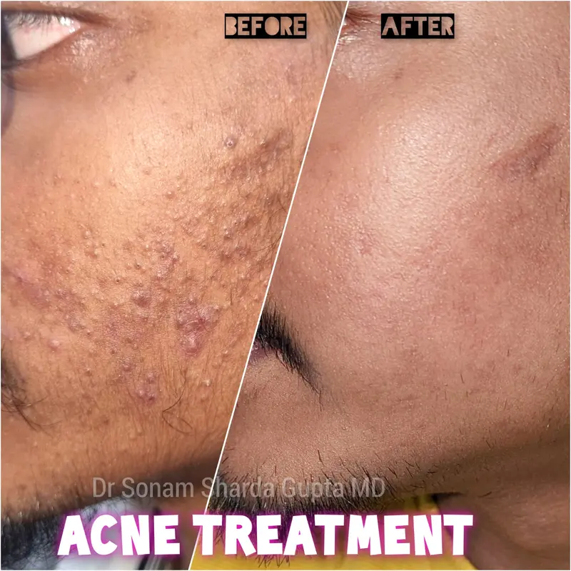 Dermatologist near Dhantoli