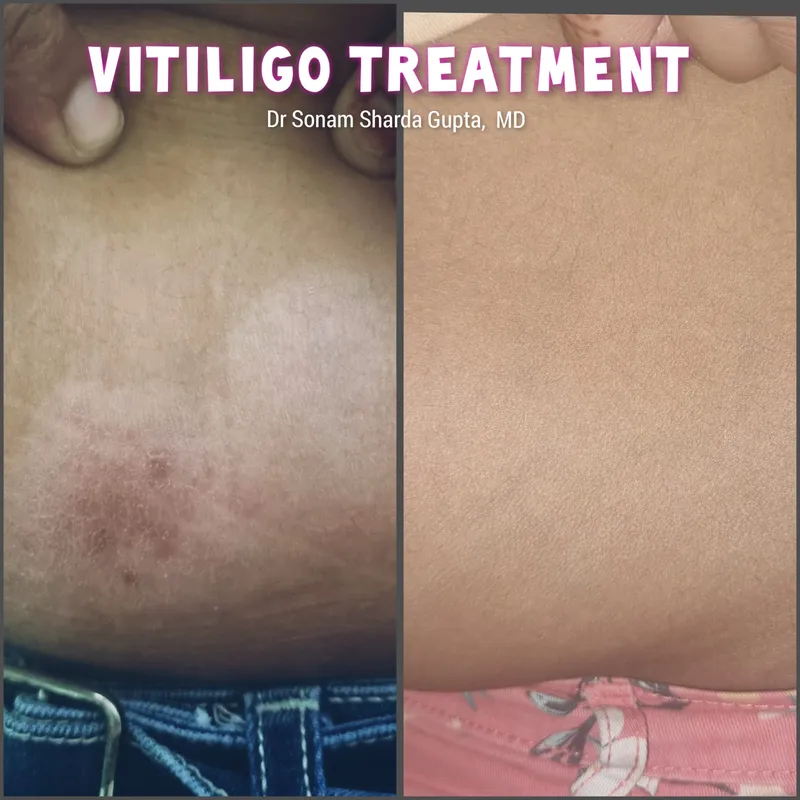 Dermatologist near Dhantoli