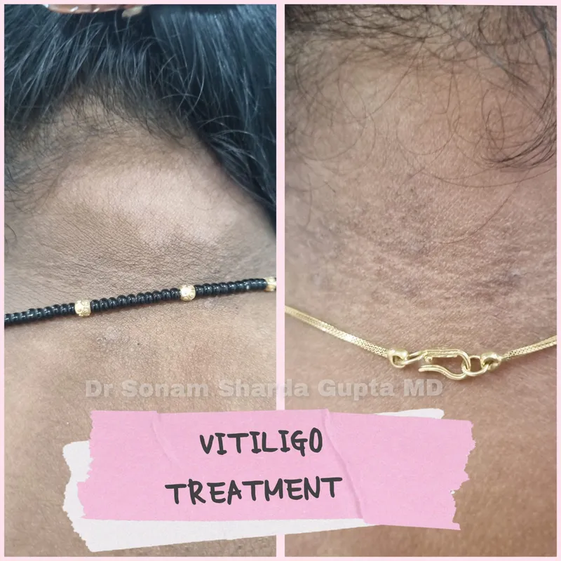 Dermatologist near Dhantoli