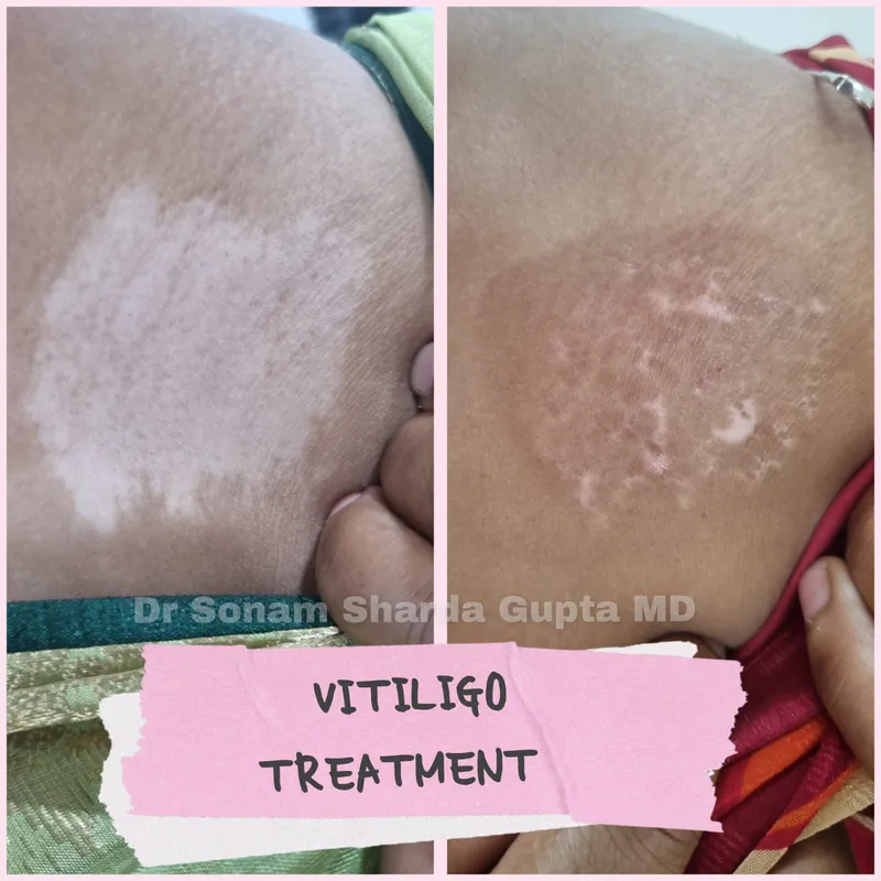 Dermatologist near Dhantoli
