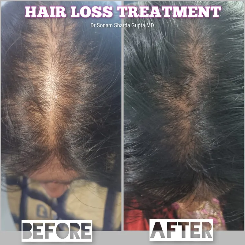 Dermatologist near Dhantoli