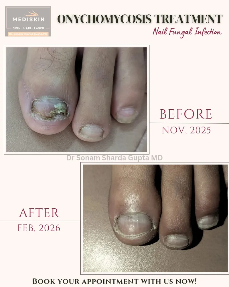 Dermatologist near Dhantoli