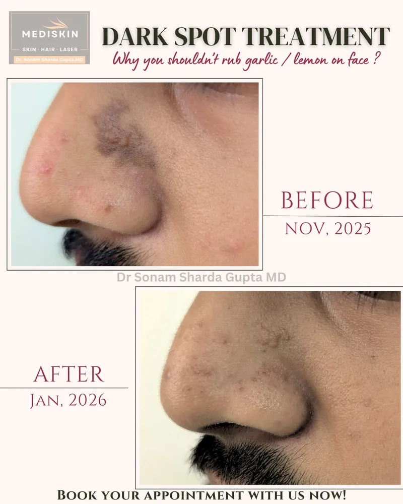 Dermatologist near Dhantoli