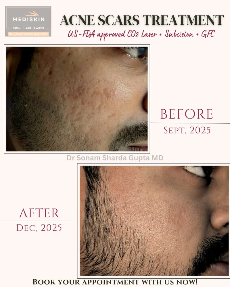 Dermatologist near Dhantoli