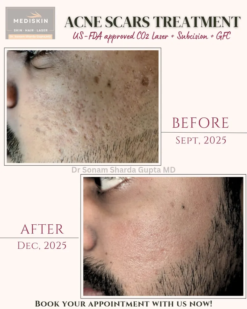 Dermatologist near Dhantoli