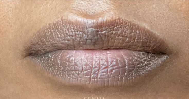 Dark Lips Treatment