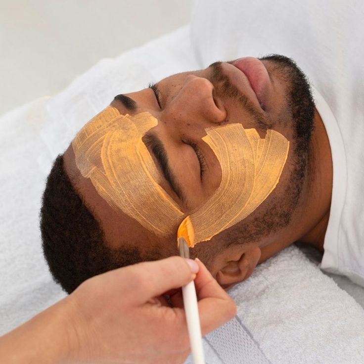 Glycolic Peel